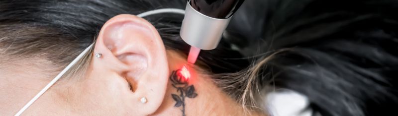 From ink regret to radiant skin a journey of transformation with laser clinic and skin care treatment at a trusted cosmetic clinic.