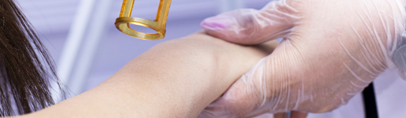A professional in a green uniform and protective goggles performs laser tattoo removal on a patient's leg in a clinical setting, with medical equipment and a window in the background.