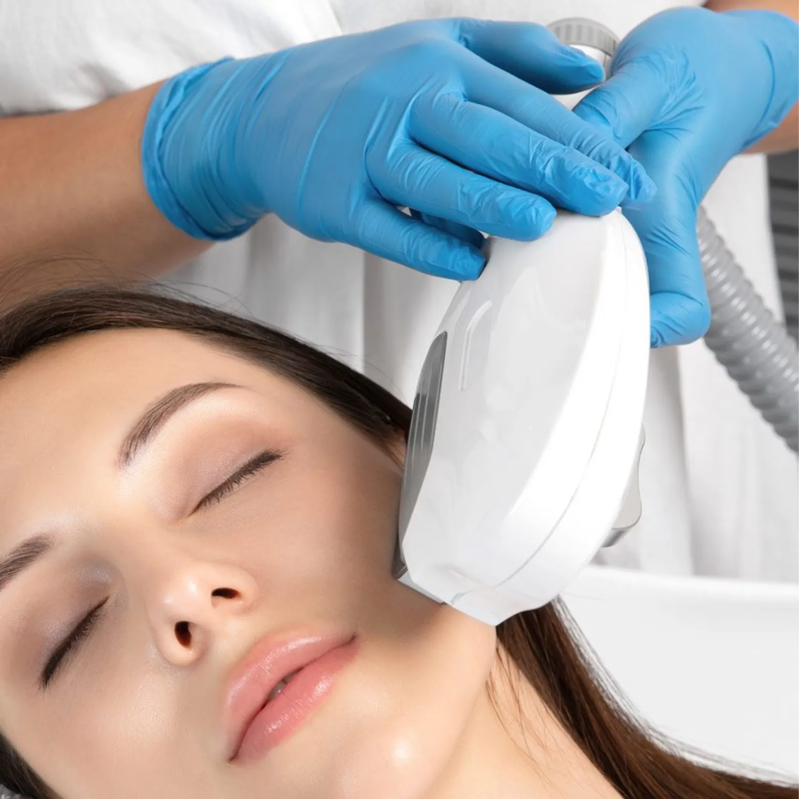 Intense Pulsed Light Treatment