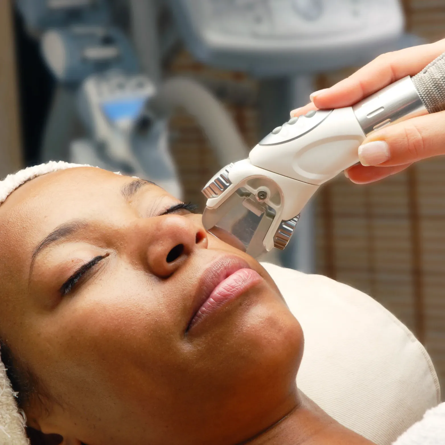 Laser for Dark Skin