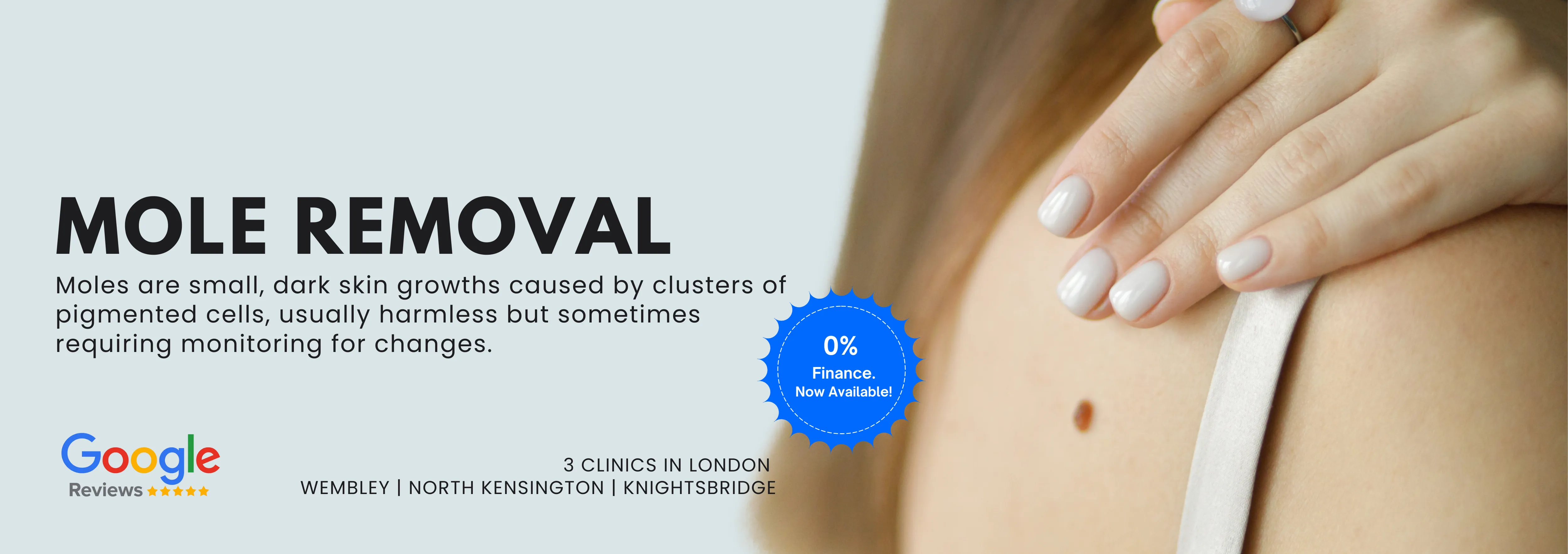 Mole Removal