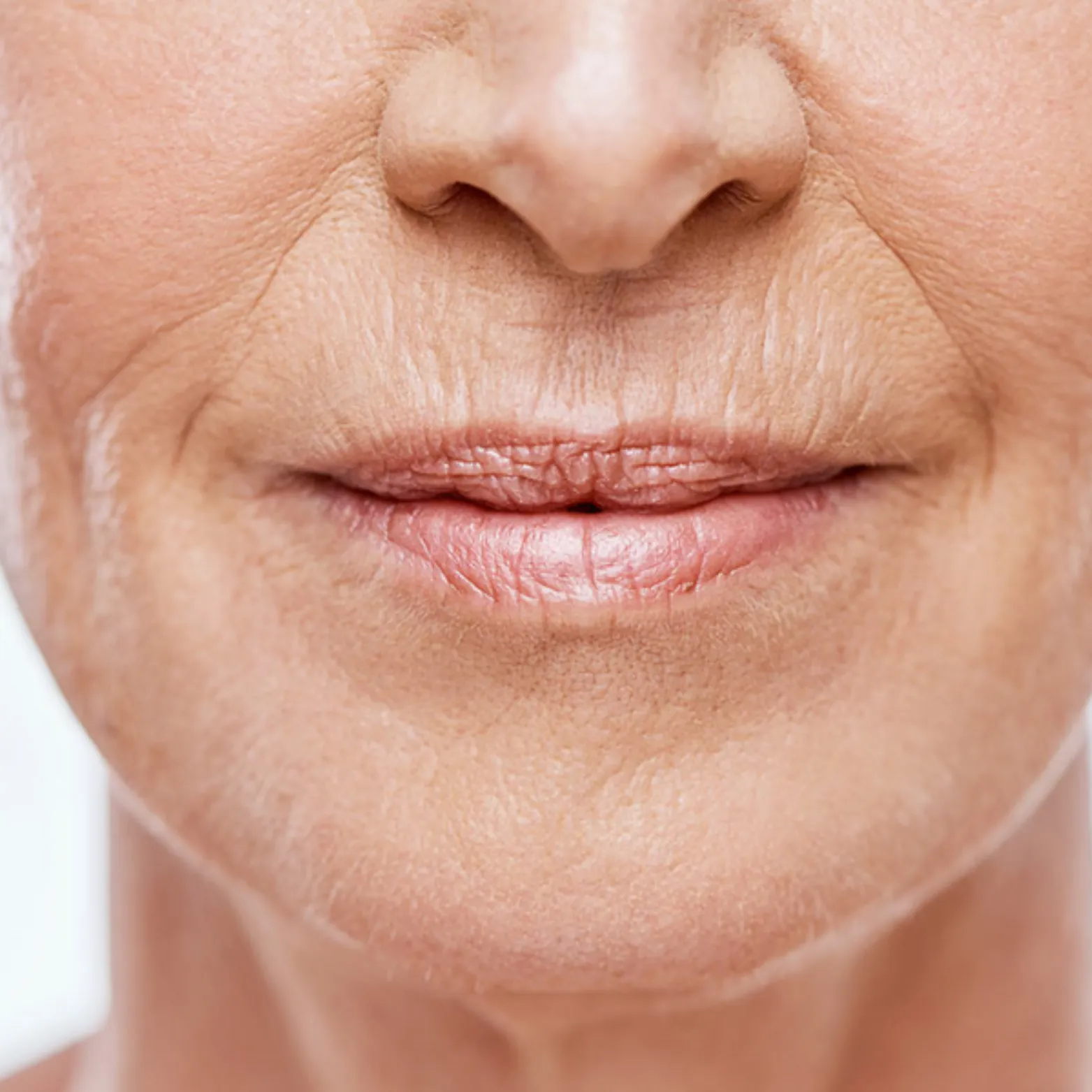 Mouth Lines