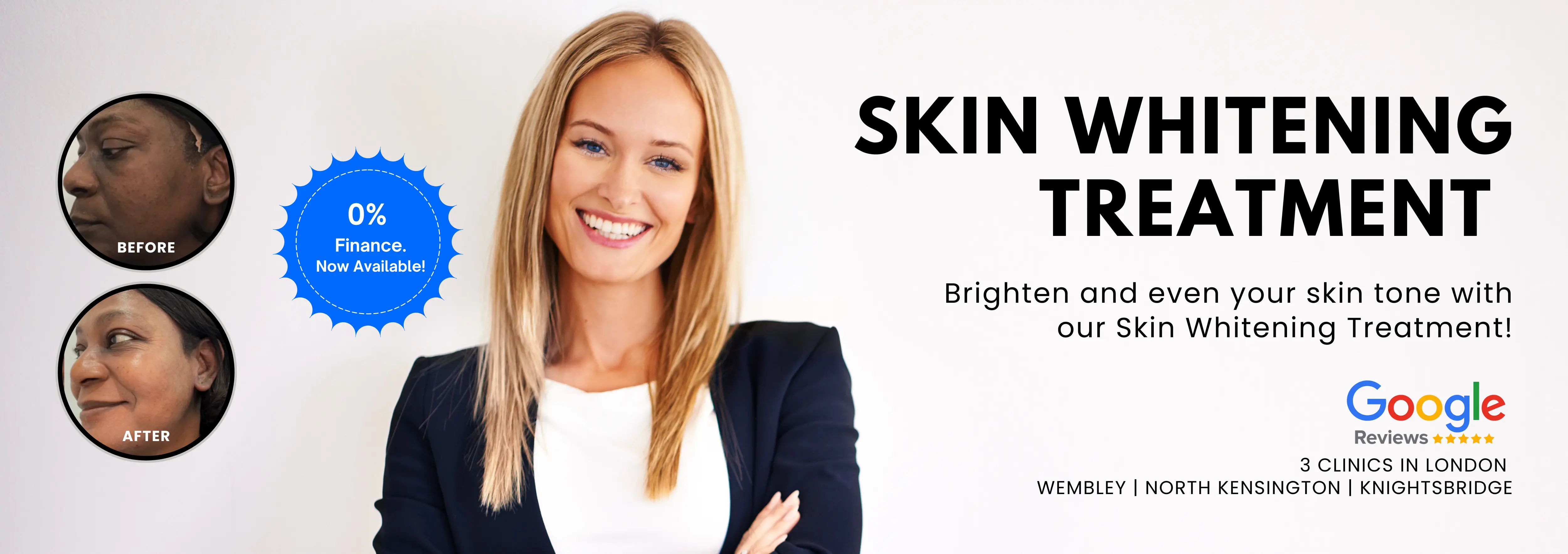Skin Whitening Treatment