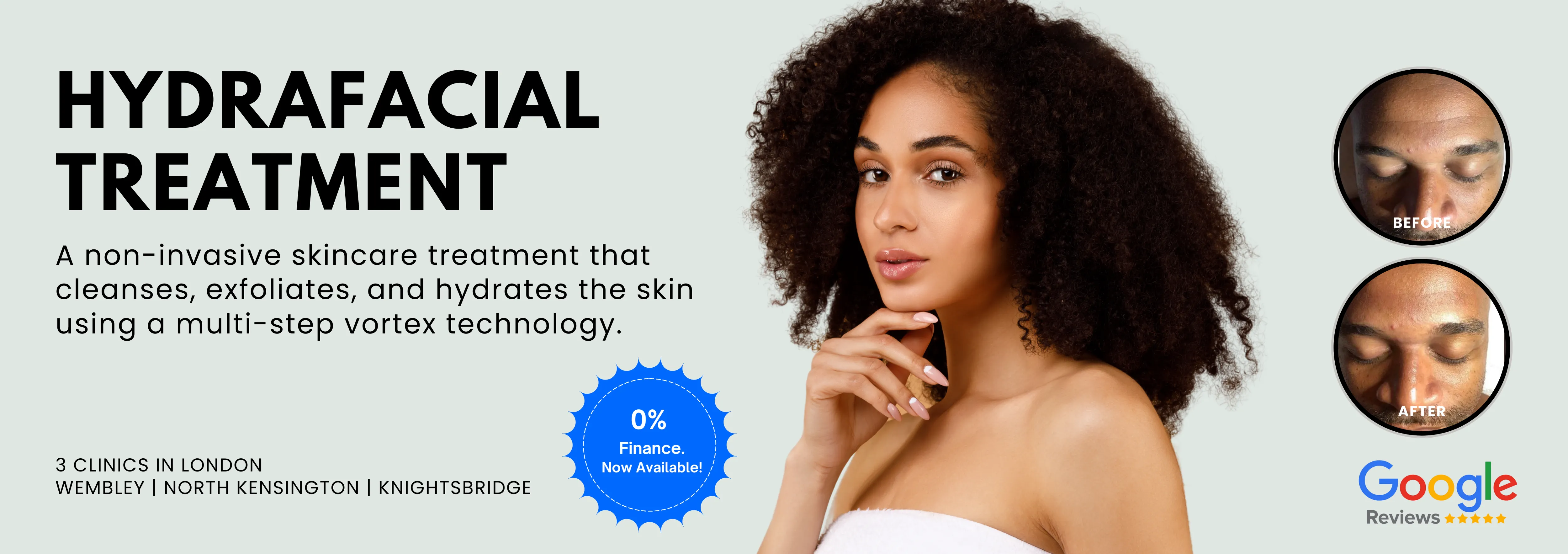 HydraFacial Treatment