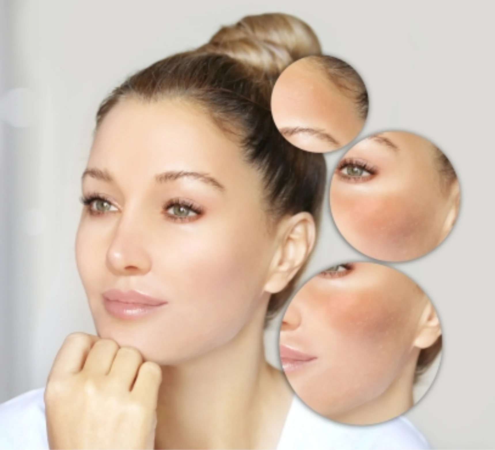 Skin Whitening Treatment